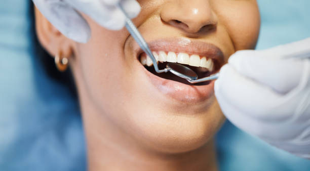 Best Knocked-Out Tooth Emergency  in Brenham, TX